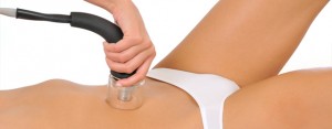 laser lipolisis