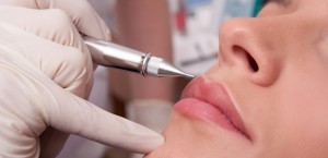injection levres