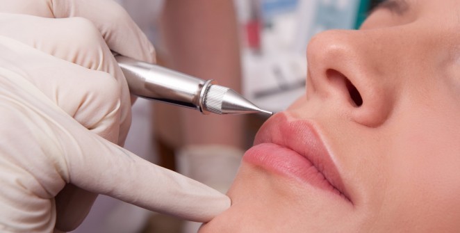 injection levres