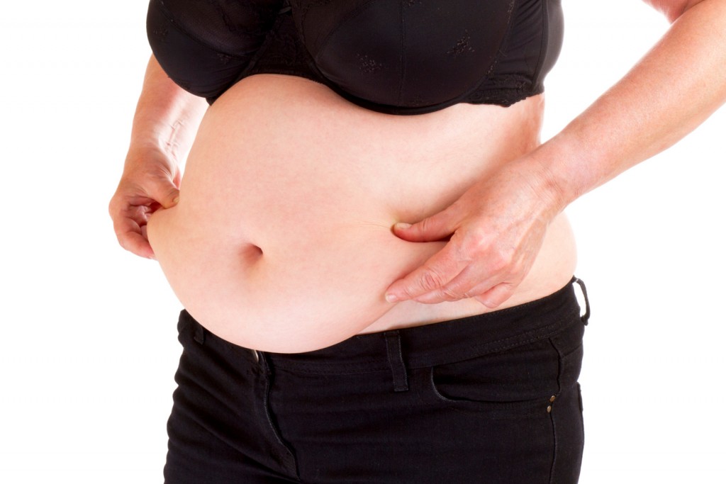 liposuccion-abdominoplastie